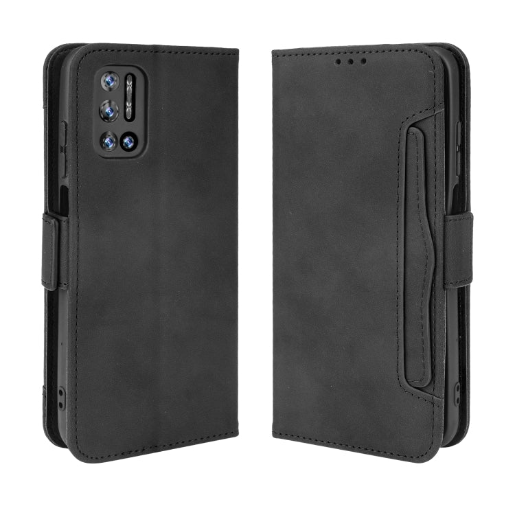 For Doogee N40 Pro Skin Feel Calf Pattern Horizontal Flip Leather Case with Holder & Card Slots & Photo Frame(Black) - More Brand by buy2fix | Online Shopping UK | buy2fix
